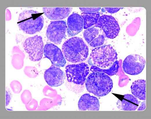 Peter Maslak, Memorial Sloan-Kettering Cancer Center