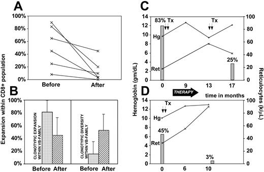 Figure 5. Clonotypic expansions and disease course. Changes in the size of LGL clone were recorded prior to and after oral cytoxan therapy resulting in remission in 6 patients. (A) Clonotype expansions within CD8 cell population (percent of VB family within CD8+ population multiplied by % of identical sequences within a VB family). (B) Comparisons of redundancy (defined as percent of the pathogenic clone within VB family) before (▦) and after (▨) therapy and diversity (defined as percent of different clones within all clones sequenced). (C-D) Examples of the changes of clonal size expressed as percent of the total CD8 spectrum during the course of disease in 2 patients with LGL leukemia associated with pure red cell aplasia (▦). Lines represent the hemoglobin levels (+) and absolute reticulocyte counts (×). Tx and arrows indicate transfusions; Hg, hemoglobin; and Ret, reticulocytes. Error bars represent 2 SD.