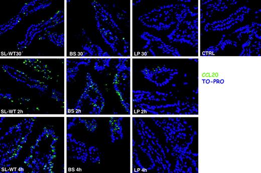 Figure 1. CCL20 (MIP-3α) is expressed in response to flagellated bacteria, regardless of their invasiveness. Ileal ligated loops were carried out in the intestine of C57BL/6 mice. 108 CFU of bacteria (S typhimurium: SL-WT; B subtilis: BS; L plantarum: LP) were injected into the loops. CTRL indicates control mice injected with PBS. Mice were killed at the indicated time points. Cryosections were stained with anti-CCL20 antibody (green) and with TO-PRO (blue) to detect nuclei. BS is a flagellated noninvasive bacterium and induces CCL20, whereas LP that is not flagellated does not. One of 2 independent experiments is shown.