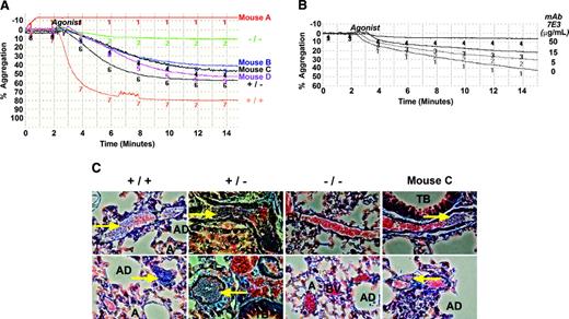 Figure 3. Platelet function was restored in recipients of β3-transduced marrow. (A) Aggregation was measured ex vivo following incubation of washed platelets with fibrinogen and a cocktail of activation agonists (ADP, epinephrine, and PAR4). Platelets from β3-transduced marrow recipients A to D as well as β3–/–, β3+/–, and β3+/+ control samples aggregated in direct correlation with the level of β3 on their platelets. These results were observed for each mouse in at least 2 separate experiments. (B) Aggregation was measured ex vivo following a 30-minute pretreatment of platelets at 37°C with αIIbβ3 and αvβ3 complex–specific antibody, 7E3 (known to inhibit platelet aggregation),16 followed by incubation of washed platelets with human fibrinogen and a cocktail of platelet activation agonist (ADP, epinephrine, and PAR4). Shown is the aggregation profile of a mixture of platelets from β3-transduced marrow recipients E to F, which was increasingly inhibited with higher concentrations of 7E3 (0-50 μg/mL). This result represents the outcome of 3 separate experiments. Aggregation was not inhibited with nonspecific mouse Ig. (C) In vivo platelet function was examined by light microscopic analysis of fixed lung tissue stained with trichrome following intravenous injection of a platelet agonist (ADP) into mice (magnification, 400×). Thromboemboli (blue, arrows) formed in the pulmonary blood vessels (BV) of β3+/– and β3+/+ controls, while platelets in β3–/– animals were unable to form emboli. In contrast to results with β3–/– mice, platelets within transplant recipient C formed emboli that occluded the pulmonary blood vessels. A indicates alveolus; AD, alveolar duct; and TB, terminal bronchiole. This result represents the outcome observed after viewing several sections of each lung from 8 controls (3 β3–/–, 2 β3+/–, and 3 β3+/+ mice) and 3 mice expressing human β3. Images were captured with a Nikon Eclipse TS100 microscope (Nikon, Tokyo, Japan) using a 40×/0.55 numeric aperture objective.