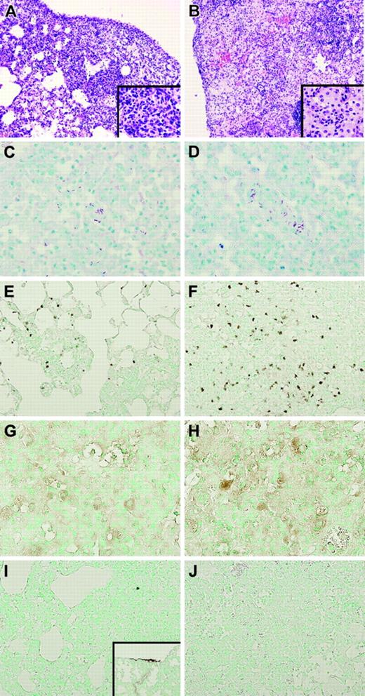 Figure 3. Lungs of TMpro/pro mice show more confluent inflammation and an enhanced neutrophil influx. Representative histopathologic sections of lungs of WT (A) and TMpro/pro (B) mice 5 weeks after inoculation with M tuberculosis showing granulomatous inflammatory infiltrates in WT (original magnification × 10, A; × 40, inset) and confluent areas of inflammation in TMpro/pro mice (original magnification × 10, B; × 40, inset). Mycobacteria were easily found in ZN staining of lungs in both groups (original magnification × 40, C-D). Enhanced neutrophil influx was observed in TMpro/pro mice (original magnification × 20, F) compared with WT mice (original magnification × 20, E). Macrophages were observed in both groups (original magnification × 20, G-H). Fibrin(ogen) could not be detected in either group (original magnification × 20, I-J; inset I: positive control for fibrin(ogen) staining showing lung tissue 48 hours after induction of pneumococcal pneumonia, original magnification × 10). Figures are representative of n = 5 for each group.