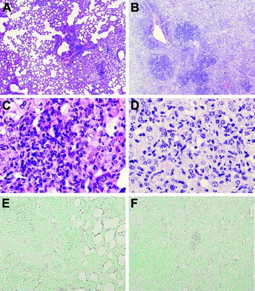 Figure 6. Lungs of TMpro/pro mice are diffusely inflamed 36 weeks after infection. Representative lung sections of WT (original magnification × 4, A) and TMpro/pro (original magnification × 4, B) mice 36 weeks after infection, showing more confluent and dense inflammation in TMpro/pro mice than in WT mice. Monocytes and lymphocytes are the dominant inflammatory cell types in WT mice (original magnification × 40, C) compared with large, “foamy” macrophages in TMpro/pro mice (original magnification × 40, D). At this late time point, fibrin(ogen) is still undetectable (original magnification × 20, E-F). Figures are representative of the remaining mice presented in Figure 4 (9/14 TMpro/pro mice and 14/14 WT mice).