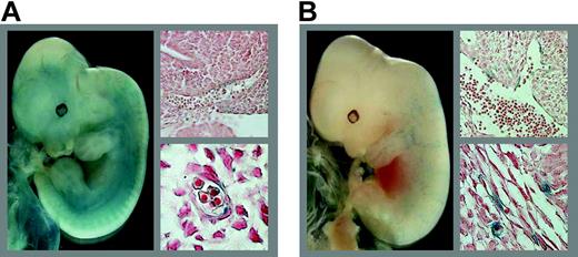 Figure 6. LMO2 proximal promoter directs endothelial expression in transgenic mice. E12.5 transgenic embryos expressing lacZ under the control of the LMO2 proximal promoter. (A) A representative embryo with endothelial staining discernible from whole-mount analysis and confirmed by histologic sections of a blood vessel (top right) and a capillary (bottom right). (B) The founder embryo with scattered β-galactosidase staining subsequently demonstrated to represent endothelial activity by histologic sectioning of the dorsal aorta (top right) and capillaries (bottom right). Whole-mount images were acquired using a Pixera Pro 150ES digital camera (Pixera, Los Gatos, CA) attached to a Nikon SM7800 microscope (Nikon, Kingston upon Thames, United Kingdom). Images of sections were acquired with the same camera attached to an Olympus BX51 microscope (Olympus, Southall, United Kingdom) using Olympus UPlanApo 40 ×/0.85 numeric aperture (NA) and 100 ×/1.35 NA objectives. ImagePro Express version 4.5 (Image Processing Solutions, North Reading, MA) was used for acquisition of both types of images. Digital images were processed using Adobe Photoshop (Adobe Systems, San Jose, CA).
