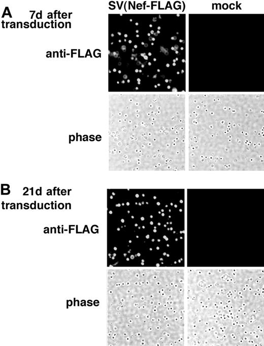 Figure 2. Immunostaining demonstrates FLAG expression in rat BMMNCs transduced with SV(Nef-FLAG) in vitro. Rat BMMNCs were selected by centrifugation over Ficoll-Hypaque and transduced with SV(Nef-FLAG) or SV(BUGT) (negative control) as described in “Materials and methods.” FLAG expression in transduced rat BMMNCs was analyzed by intracellular immunostaining. (A) Seven days after transduction; (B) 21 days after transduction. Original magnification, × 200.