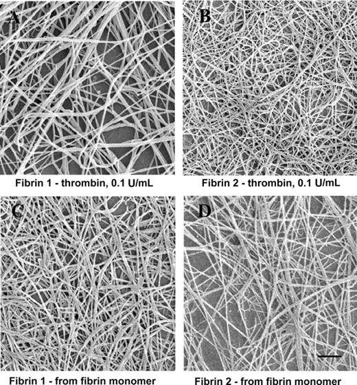 Figure 1. SEM images of fibrin formed by thrombin addition to fibrinogen or by repolymerization of fibrin monomer solutions. (A) Fibrinogen 1 plus thrombin. (B) Fibrinogen 2 plus thrombin. (C) Fibrin 1 monomer. (D) Fibrin 2 monomer. Bar represents 1 μm.