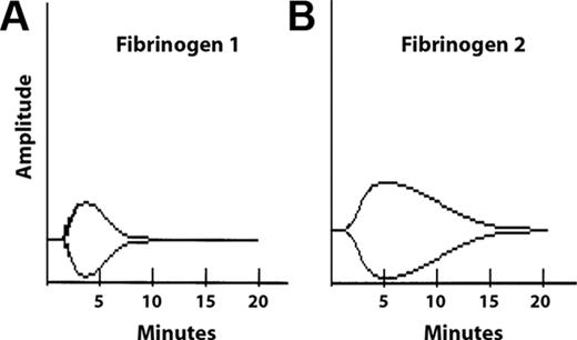 Figure 6. Thromboelastograms showing polymerization and tPA-mediated lysis of fibrinogen 1 or fibrinogen 2. Reaction mixtures contained fibrinogen (7 mg/mL) and lys-plasminogen (2.0 μM). Thrombin (2 U/mL, final) and tPA (0.93 nM, final) were added to initiate the reactions. (A) Fibrinogen 1. (B) Fibrinogen 2.