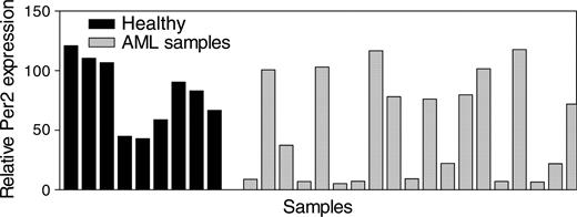 Figure 5. Expression of Per2 in AML. Expression levels of Per2 were measured in light density, mononuclear bone marrow samples (enriched for less differentiated, dividing cells) from 9 healthy donors (Healthy) and 21 patients with AML. The results are expressed in arbitrary units as a ratio of the Per2 transcripts to GAPDH transcripts (each value represents the mean of 3 measurements of the sample).