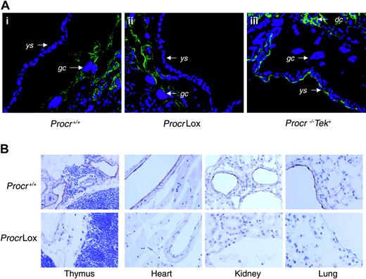 Figure 2. EPCR immunostaining. (A) EPCR staining is readily detected on the giant trophoblasts in (i) Procr+/+ and (ii) ProcrLox embryos at E9.5, whereas no EPCR is observed on the giant trophoblast cells of the (iii) Procr –/–Tek+ embryo. Fluorescein identifies EPCR antigen. (B) Immunohistochemical detection of EPCR in thymus, heart, kidney, and lung in Procr +/+ and ProcrLox mice. Brown horseradish peroxidase reaction product identifies EPCR antigen. EPCR is absent in ProcrLox mice from all large-vessel endothelium. gc indicates trophoblast giant cell; ys, yolk sac; and dc, decidual cell. Original magnification for all panels, × 200.