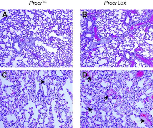 Figure 3. Pulmonary histopathologic analysis of ProcrLox and Procr +/+ mice after high-dose factor Xa/PCPS administration. Immunohistochemical detection of fibrin deposition in the lung of (A) Procr +/+ and (B) ProcrLox mice. Red alkaline phosphatase reaction product identifies fibrin/fibrinogen antigens. ProcrLox mice showed much more intravascular fibrin deposition than Procr +/+ mice. Hematoxylin and eosin (H&E) staining showed more and larger intravascular thrombi in the pulmonary vessels in (D) ProcrLox mice than in (C) Procr +/+ mice. (C-D) Arrows indicate thrombi and red staining indicates red blood cells trapped in the vessels. Slides are representative of 4 mice per group. Fluorescence quantitation shows that the AFI of fibrin/fibrinogen staining is more in ProcrLox mice than wild-type mice (1342 ± 668 vs 388 ± 205, n = 4, P < .05). Original magnification for all panels, × 100.