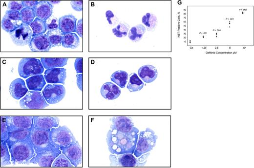 Figure 1. Morphologic and functional changes induced by gefitinib in AML cell lines. May-Grünwald Giemsa staining of HL-60 cells treated with (A) 0.02% DMSO and (B) 10 μM gefitinib for 4 days, Kasumi-1 cells treated with (C) 0.01% DMSO and (D) 5 μM gefitinib for 3 days, and U937 cells treated with (E) 0.02% DMSO and (F) 8 μM gefitinib for 3 days. Doses were chosen at which optimal differentiation occurs. Images were acquired with an Olympus BH-2 microscope (Melville, NY), × 100/1.25 magnification under oil, an Olympus Q-Color 5 digital camera, and Adobe Photoshop CS version 8.0 software (San Jose, CA). (G) HL-60 cells were treated in triplicate for 5 days with gefitinib in a 2-fold dose response series from 10 μM to 1.25 μM and the percentage of NBT-positive cells compared with DMSO-treated controls (Ctl) with a one-tailed t test analysis.