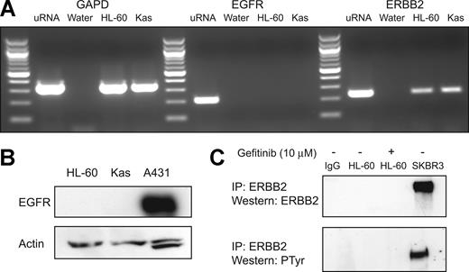 Figure 4. Gefitinib-induced differentiation is EGFR independent. (A) RT-PCR (40 cycles) was performed to evaluate for EGFR and ERBB2 transcript presence in HL-60 and Kasumi-1 cells. GAPD was amplified as a control to demonstrate intact cDNA. Negative water controls and a positive cDNA control (uRNA) synthesized from universal Stratagene RNA were also included. (B) Western immunoblotting was performed to evaluate for the presence of EGFR protein in HL-60 and Kasumi-1 whole-cell lysates (50 μg) with anti-EGFR antibody. An EGFR-expressing positive control, A431 epidermoid carcinoma cells, was included. (C) Immunoprecipitation (IP) was performed with anti-ERBB2 and a mouse IgG control antibody to evaluate for the presence of ERBB2 protein in HL-60 cells with and without 10 μM gefitinib stimulation. Total lysate from SKBR3, a breast cancer cell line known to overexpress ERBB2, was used as a positive control. Western immunoblotting was performed with ERBB2 or a cocktail of 4G10 and pY100 antiphosphotyrosine (PTyr) antibodies.