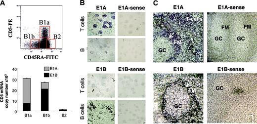 Figure 3. E1A and E1B transcripts are differentially produced in B and T lymphocytes. (A) Tonsillar B-1a, B-1b, and B-2 cells were sorted based on their membrane expression of CD5 and CD45RA. The numbers of E1A- and E1B-containing transcripts were determined in these 3 subpopulations by quantitative PCR. (B) In situ hybridization analysis of cytospun tonsillar T and B cells (× 400) with sense and antisense probes for E1A (top) and E1B (bottom). The transcripts were revealed using digoxigenin-labeled probes. E1B transcript–containing cells are denoted by the arrows. (C) Localization of E1A and E1B transcript–containing cells (arrows) in tonsil sections (× 100). Germinal center (GC), follicular mantle (FM), and T-cell areas are indicated. Images were captured using a Zeiss Axioplan microscope (Zeiss, Oberkochen, Germany) using 40 ×/0.75 numeric aperture (NA) (B) and 10 ×/0.30 NA (C) objectives. Images were acquired with an Olympus Camedia C-4040 zoom digital camera and Camedia master 2.5 imaging solution, and were processed using Adobe Photoshop (Adobe Systems, San Jose, CA).