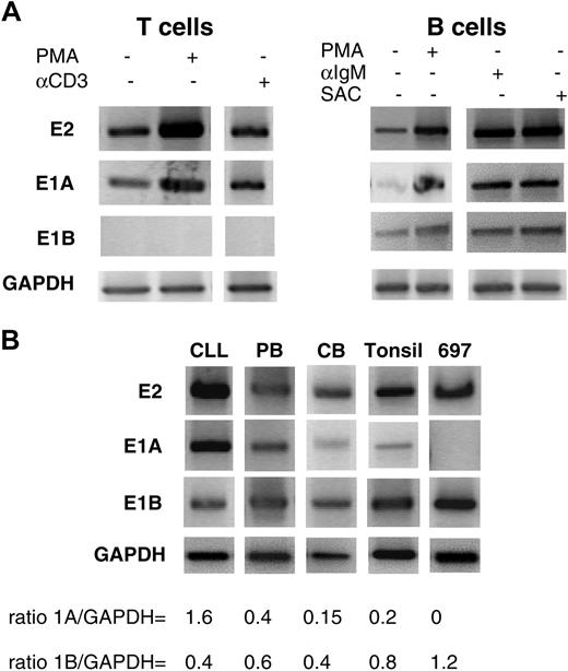 Figure 4. E1A and E1B in resting and stimulated lymphocytes. (A) Stimulation of T and B cells. Sense primers specific for CD5 E1A, E1B, and exon 2, with antisense primers located at the exons 5-6 junction, were used in RT-PCR. (B) Expression of E1A, E1B, and exon 2 transcripts in B cells from different sources (CLL, chronic lymphocytic leukemia; PB, peripheral blood; tonsil, tonsillar cells; CB, cord blood).