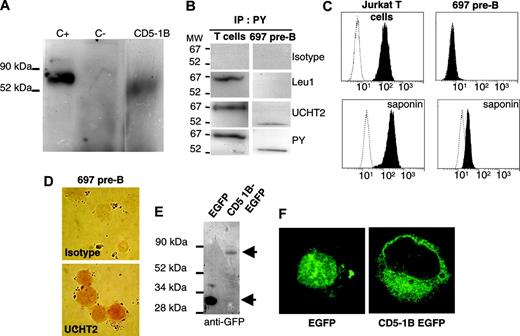 Figure 5. Alternative CD5 E1B motif encodes a truncated isoform of CD5 protein starting at exon 3 and retained intracellularly. (A) In vitro translation of CD5 using pLuc (C+), pDNRdual (C–), CD5-1B pDNRdual (CD5-1B) using the TNT T7-coupled reticulocyte system. (B) Precipitation of CD5 in T cells and 697 pre-B cells using antiphosphotyrosine (PY). MW indicates molecular weight; IP, immunoprecipitation. (C) FACS analysis of Jurkat T and 697 pre-B cells for CD5 protein expression in the absence (membrane CD5) or in the presence (intracellular CD5) of saponin. Filled histograms denote CD5 staining; open histograms, isotypic controls. (D) Immunohistochemical staining with UCHT2 of saponin-treated 697 pre-B cells. Images were acquired as in Figure 3B. (E) Western blot analysis of COS-1 cells transfected with EGFP-expressing vector, or fusion CD5 E1B transcript and EGFP. Top arrow indicates CD5-1B–EGFP; bottom arrow, EGFP. (F) Confocal microscopy analysis (× 1000) of the subcellular localization of fusion CD5 E1B transcript and EGFP in COS-1 cells. Confocal images were acquired using constant settings on a Leica TCS-NT fluorescence microscope with a 100 ×/1.40 NA oil objective using a FITC filter and Leica TCS-NT software version 1.6.587 (Leica Microsystems, Bensheim, Germany). Image sizes were adjusted using Adobe Photoshop.