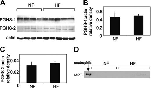 Figure 7. Expression of COX-1, -2, and MPO in HF and NF platelets. (A) Protein from washed platelets (3 μg protein) was separated by sodium dodecyl sulfate–polyacrylamide gel electrophoresis (SDS-PAGE) as described in “Patients, materials, and methods.” Membranes were probed using anti–COX-1, anti–COX-2, or antiactin, and immunoreactivity was revealed using anti–IgG-HRP secondary conjugates and ECL. Arrow shows bands corresponding to HF subject studied in Figure 5. (B) Relative density of COX-1 and actin in HF and NF samples shows no difference in COX-1 expression between subject groups. (C) Relative density of COX-2 and actin in HF and NF samples shows no difference in COX-2 expression between subject groups. Mean ± SEM, n = 4–5 separate patients. (D) Protein from washed platelets (3 μg protein) or human neutrophils (1.5 μg) was separated by SDS-PAGE as described in “Patients, materials, and methods” and probed using anti–human MPO and revealed using anti–IgG-HRP secondary antibody and ECL.