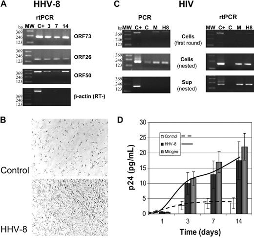 Figure 5. Reactivation of HIV in PBMCs isolated from patients with asymptomatic HIV. PBMCs were infected with HHV-8 (H8) or treated with mitogens (M) and analyzed at the indicated times after infection. (A) rtPCR analysis for the presence and transcription of HHV-8; the results shown refer to one patient, but similar results were obtained for all the 14 subjects analyzed. MW indicates molecular weight marker. (B) Phase-contrast photomicrograph of HHV-8-infected PBMCs. A Nikon Eclipse TE2000-S microscope was used (with a 10 ×/2.8 numeric aperture objective), equipped with a DM100 digital camera (all from Nikon, Tokyo, Japan). (C) Results of PCR and rtPCR analyses of HIV load in cells and culture supernatant at 7 days after infection (same patient as A); similar results were obtained in 12 of 14 patients. (D) p24 antigen release in culture supernatant of control, HHV-8-, or mitogen-treated PBMCs from patients with HIV. Each value represents the mean of duplicate samples of the 12 responder patients. Error bars indicate SD.