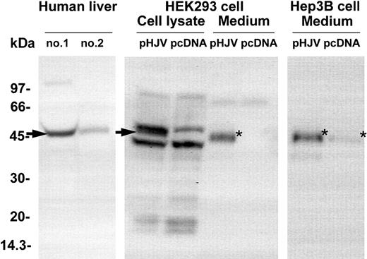 Figure 3. Hemojuvelin protein exists in both cell-associated and soluble forms. HEK293 and Hep3B cells were transfected with pcDNA3.1(+) or pcDNA-HJV in 6-well tissue culture plates and incubated overnight, followed by a 24-hour incubation in serum-free medium (2 mL/well). Whole-cell lysates were collected in 150 μL NETT buffer per well and 30 μL cleared total protein solution was analyzed. Conditioned cell culture media (2 mL/sample) were filter concentrated (5-kDa cut-off) and concentrates equivalent to 800 μL starting material were analyzed. Western blots after reducing SDS-PAGE were probed with anti-G3pep2-3 antibody. Arrows indicate cell-associated hemojuvelin (apparent molecular weight, 46 kDa) in both human liver protein extracts (no. 1 and no. 2) and whole-cell lysate of HEK293 cells transfected with pcDNA-HJV (pHJV), but not in HEK293 cells treated with control vector (pcDNA). Soluble hemojuvelin (apparent molecular weight, 44 kDa) is indicated by the asterisk and seen in conditioned cell culture media from HEK293 and Hep3B cells transfected with pcDNA-HJV (pHJV), as well as in conditioned media from Hep3B cells transfected with control vector (pcDNA) but not in media from HEK293 cells treated with control vector (pcDNA).