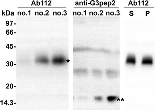 Figure 4. Soluble hemojuvelin is present in human serum and plasma. Serum and plasma samples were separated on reducing SDS-PAGE. In Western blot analysis of all serum samples, Ab112 detected a protein band (*) of 30 kDa (3 different donors nos. 1-3, left panel), and anti-G3pep2-2 antibody detected a protein band (**) of 16 kDa (middle panel). Pretreatment of Ab112 with excess rs-hemojuvelin abolished the 30-kDa Western blot signal (Figure S3). Blood plasma (1 μL, P, right panel) probed with Ab112 contained bands identical to those of serum from the same donor (1 μL, S, right panel) indicating that the hemojuvelin cleavage was not caused by the clotting reaction.