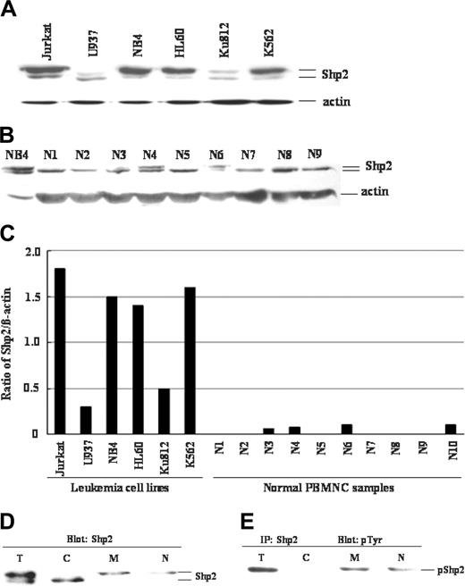 Figure 1. Altered expression, subcellular localization, tyrosine phosphorylation of Shp2 in human leukemia cell lines. (A) Cell lysates (20 μg total proteins) were analyzed by Western blot with antibodies against Shp2 or β-actin, as a control for equal sample loading. (B) For normal hematopoietic cell samples (PBMNCs), 30 μg total proteins were loaded for Western blot analysis for Shp2 and β-actin, while 5 μg total proteins from NB4 leukemia cell lysate was used as a positive control for the 2 Shp2 bands and for comparison of the relative Shp2 contents. (C) The histogram shows p-Shp2 protein levels normalized against the actin expression in leukemia cell lines and normal PBMNC samples. Data are representative of 3 independent experiments. (D) Leukemic cells were lysed in hypotonic buffer, and lysates were used to prepare total cellular protein (T), cytosolic (C), membrane-soluble (M), and nucleus (N) fractions as described in the text. An aliquot of each fraction (20 μg total proteins) was subjected to immunoblot analysis for Shp2. (E) Proteins were immunoprecipitated from each fraction with an anti-Shp2 antibody and subjected to immunoblot analysis with an antiphosphotyrosine (pTyr) antibody. IP indicates immunoprecipitation. Data are representative of 2 independent experiments.