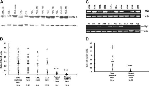 Figure 2. Increased Shp2 expression in primary leukemia cells. (A) A representative Western blot result of partial leukemia cases. (B) Statistical analysis of all cases tested. For each sample, 20 μg cellular proteins was analyzed by Western blot for Shp2 and β-actin. Results were expressed as the ratios of Shp2 to β-actin, and the mean value in each group was indicated. (C) Total RNA was isolated from fresh leukemia cell samples from patients at diagnosis, and analyzed by RT-PCR using Shp2-specific primers described in the text. β-actin cDNA primers were used as internal control. PCR products were electrophoresed on 1% agarose gel stained with ethidium bromide. (D) Results were expressed as the ratios of Shp2 to β-actin. Horizontal lines in panels B and D represent means.