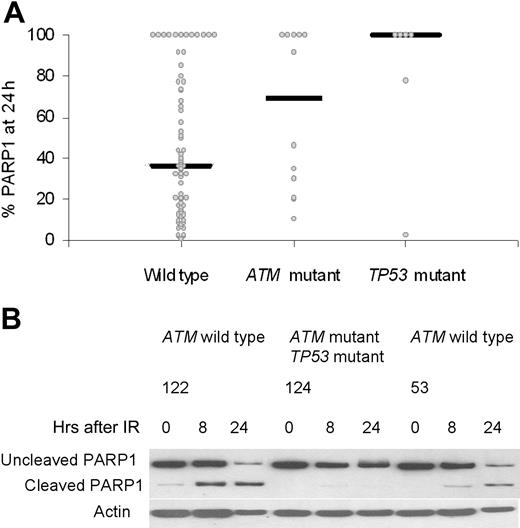 Figure 5. The effects of ATM and TP53 mutations on damage-induced apoptosis measured by cleavage of PARP1. (A) The percentage of the initial PARP1 remaining at 24 hours after IR was plotted for each tumor in each genetic category. There was no activation of apoptosis, as indicated by the 100% remaining uncleaved PARP1. Median values for the percentage of PARP1 remaining at 24 hours are shown for all genetic subgroups and were statistically significantly different (P = .019). (B) In CLLs 122 and 53, with wild-type ATM and TP53 genes, there was cleavage of PARP1 at both 8 and 24 hours after irradiation, reaching a maximum at 24 hours. In CLL 124, with one ATM mutation and one TP53 mutation, PARP1 cleavage was absent even at 24 hours.