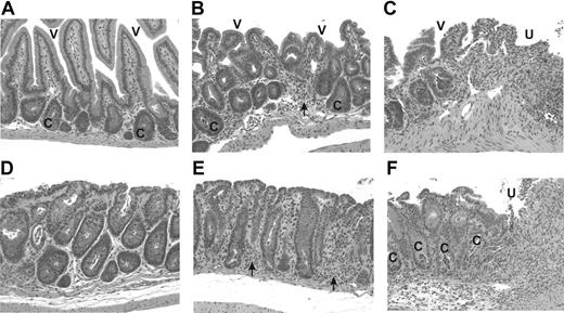 Figure 4. Delayed administration of bortezomib significantly increases gut histopathologic damage in mice with GVHD. B6 (H2b) recipients of BALB/c (H2d) 10 million bone marrow and 15 million spleen cells were treated with or without 15 μg bortezomib per dose daily on day 12 after BMT. The next day (day 13) mice were humanely killed and gut tissue was collected, processed, and stained with hematoxylin and eosin. (A-C) Small intestine from mice without delayed bortezomib treatment (A) have hyperplastic crypts (c) but normal villi (v). In contrast, the small intestines from mice with delayed bortezomib treatment (B-C) have villous blunting and fusion (v), hyperplastic crypts (c), and an inflammatory infiltrate (arrow). Other areas of small intestine are ulcerated (u) with a base of inflammatory cells. (D-F) Colons from mice without delayed bortezomib treatment (D) display relatively normal morphology. In contrast, colons from mice with delayed bortezomib treatment have increased (E) goblet cell depletion and inflammatory cells (arrow) in the lamina propria. Other areas of colon (F) are ulcerated (u), have sloughed cells in crypt lumens (c), and inflammation in the ulcer base and the submucosa (Sm). Original magnification × 200.