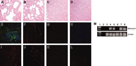 Figure 5. Detection of transduced CD8+ and CD4+ T cells in vivo. The scid mice were given intravenous injections of MDA-MB-435-erbB2 tumor cells (5 × 106 cells) at day 0 followed by intravenous injection of transduced T cells at day 5. Lungs were harvested and prepared for immunohistologic analysis 16 days after tumor inoculation. Lung sections from mice that received 1:1 CD4+ (5 × 106) and CD8+ (5 × 106) scFv-CD28-ζ transduced T cells (A,E,I), unfractionated transduced T cells (107), mouse no. 1 (B-C,F), mouse no. 2 (G,J-K), or 1:1 CD4+ (5 × 106) and CD8+ (5 × 106) scFv-α-CEA-γ–transduced T cells (D,H,L) were stained with H&E, with anti-CD4 (green), anti-CD8 (red), and anti-CD11b (blue) mAbs (E-H), or with anti-tag (red) and anti-CD11b (green) mAbs (I-L). Representative fields of 5 sections analyzed are shown. Original magnification × 400. (M) Peripheral blood and spleens were harvested from mice at day 100 and used for detection of neomycin phosphotransferase mRNA (∼400 bp). Both peripheral blood (lanes 4 and 5) and spleens (lanes 7 and 8) of 2 representative mice treated with scFv-CD28-ζ–transduced CD4+ and CD8+ T cells demonstrated the presence of the neomycin phosphotransferase gene. There was no neomycin phosphotransferase detected in either the peripheral blood (lane 3) or spleens (lane 6) of normal scid control mice. As controls, β-actin was detected in all peripheral blood (lane 3) and spleen samples (lane 8) tested. No neomycin phosphotransferase or β-actin was detected in empty DNA controls (lane 2). Lane 1 = 1 kilobase (kb) Plus markers.