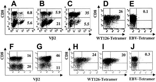 Figure 1. Surface expression of pWT126-specific TCR on transduced primary human T lymphocytes. Human T lymphocytes retrovirally transduced with genes encoding the pWT126-specific TCR (Vα1.5/Vβ2.1) chains or mock transduced were triple stained with anti–human CD3-FITC or CD8-APC antibodies and anti–human Vβ2-PE antibody or HLA-A2/pWT126 tetramers. All panels display gated CD3+ T cells. Panel A shows staining of mock-transduced T cells and panel B the pWT126 TCR-transduced T cells 2 days after transduction. After 2 rounds of antigen-specific stimulation, the percentage of T cells binding Vβ2 and CD8 antibodies increased (C). After additional in vitro expansion, tetramer staining revealed that T cells specifically bound the HLA-A2/pWT126 tetramer (D) but not an A2/EBV (Epstein-Barr virus) control tetramer (E). Similarly, T cells of a patient with CML (F) and AML (G) showed a high percentage of Vβ2+/CD8+ T cells after pWT126 TCR transduction and 2 rounds of antigen-specific stimulation (control TCR-transduced T cells contained 2% and 3% Vβ2+/CD8+ T cells, respectively). Tetramer staining of the transduced T cells of the patient with CML (H) and AML (G) showed that they bound the pWT126 tetramer but not the EBV tetramer (J shows the CML patient cells; similar lack of staining was seen with AML patient cells). Numbers indicate the percentage of cells in the quadrants.