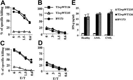 Figure 3. TCR-transduced patient T cells show WT1-specific killing activity and IFN-γ production. TCR-transduced T cells of a patient with CML (A) and AML (C) are able to kill T2 cells coated with pWT126 (pWT235 served as control) and the A2+ WT1+ leukemia line BV173. (B,D) T cells from the same CML and AML patients transduced with an irrelevant TCR (specific for Kb + pMDM100) failed to kill any of these targets. (E) TCR-transduced patient T cells show antigen-specific IFN-γ production upon stimulation with T2 cells coated with pWT126 peptide and the A2+ WT1+ leukemia line BV173. Peptide pWT235 served as control. Error bars indicate standard deviation of triplicates.