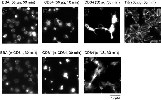Figure 2. Spreading of human platelets on the immobilized extracellular domain of CD84. Washed human platelets seeded on coverslips coated with various proteins at a concentration of 50 μg/mL. Platelets were preincubated with either 5 μg/mL α-CD84 (E and F) or isotype control Fab fragment (G) prior to seeding. Pictures are representatives of experiments repeated at least 3 times in duplicate.