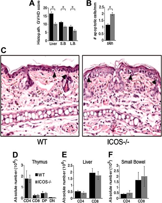 Figure 3. ICOS deficiency protects from histopathologic GVHD damage without affecting homing to target organs. Lethally irradiated (1300 cGy split) C3FeB6F1 recipients received transplants with WT B6 TCD allo-HSCs (5 × 106) and splenic T cells (1 × 106) from WT or ICOS-/- B6 donors. Each group contained 6 to 8 animals. (A-C) Histopathologic analysis of GVHD target organ damage. Recipients were killed on day 14 (liver, small and large bowel), and day 21 (skin) target organs were collected. (A-B) H&E-stained slides of liver, intestines, and skin were analyzed and scored for GVHD histopathologic damage. The graphics represent the average scores ± SEM. ⋆Statistical analyses: liver, P < .01; small bowel (S.B.), P < .01; large bowel (L.B.), P < .05; (B) skin, P < .008. (C) Skin histopathology in recipients of WT (left panel) and ICOS-/- T cells (right panel). Arrowheads denote apoptotic epidermal cells associated with infiltration by effector lymphocytes. Both qualitatively and quantitatively, epidermal injury was more severe in recipients of ICOS-/- T cells (× 400). (D) Thymic cellularity. Recipients were killed at day 21, thymi were harvested, and cells analyzed by flow cytometry. Data are shown as the average of absolute T-cell numbers ± SEM. Statistical analysis: no difference. (E) Donor T-cell content in liver. Recipients were killed at day 21, livers were harvested, and T cells were isolated and analyzed by flow cytometry. Data are shown as the average of absolute T-cell numbers ± SEM. Statistical analysis: no difference. (F) Donor T-cell content in gut. Recipients were killed at day 21, small intestines were harvested, and T cells were isolated and analyzed by flow cytometry. Data are shown as the average of absolute T-cell numbers ± SEM. Statistical analysis: no difference. Day 14 harvest data are representative of 1 experiment of 2 independent experiments (n = 6 to 8 animals). Day 21 harvest data are from 1 independent experiment (n = 6 to 8 animals).