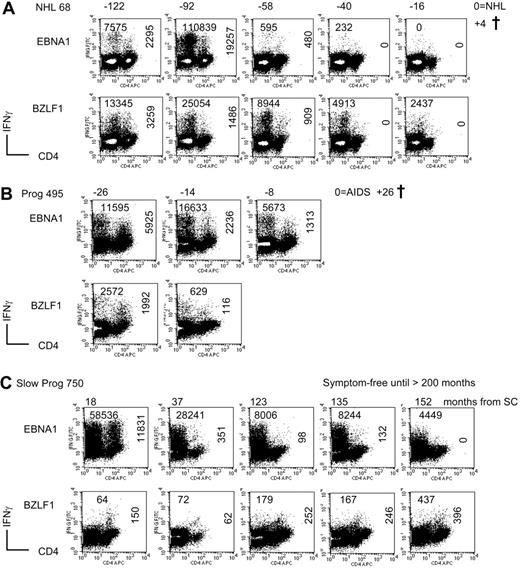 Figure 2. Decline in EBV-specific CD4+ and CD8+ memory T cells during HIV infection. Examples of EBNA1- and BZLF1-specific T-cell responses during the course of HIV infection, measured after 12 days of specific in vitro expansion. Panel A represents a subject who progressed to an EBV-related NHL, panel B represents an individual who progressed to non–EBV-related AIDS (Candida esophagitis), and panel C represents a slow progressor (asymptomatic for more than 17 years). Values in the top left corner indicate the number of CD8+ T cells that grew out of 106 PBMCs put into culture (after substraction of the medium background), whereas the vertical values in the right part of the plots indicate the number of specific CD4+ T cells. The values above the plots indicate the follow-up time in months relative to NHL or AIDS or to HIV seroconversion for the slow progressor. † indicates death; Prog, progressor; and SC, seroconversion.