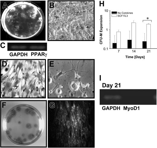 Figure 1. Multidifferentiation potential of suspension-derived cells. (A) In addition to bone nodule formation detected by UV-fluorescence excitation of tetracycline-labeled cultures (week 1 SCF plus IL-3 suspension-derived cells cultured in CFU-O conditions shown here), (B) cells containing fat globules formed under adipogenic culture conditions (× 64). (C) RT-PCR confirmed that adipogenic cultures expressed PPAR-γ. (D) Typical cells that grew in a CFU-F assay that were initiated with cells removed from SSCs of the SCF plus IL-3 treatment group after 1 week (× 32.1). CFU-F cultures were stained with α-naphthyl acetate esterase followed by a counterstain with hematoxylin solution at 2 weeks. (E) The typical cells from CFU-F assays that were initiated with suspension-derived cells cultured in the presence of SCF plus IL-3 plus 20 ng/mL PDGF-BB (×32.1). (F) At 7, 14, and 21 days of suspension culture, test populations were removed from each suspension culture and plated in CFU-M assays; at termination (day 21), the cultures were stained with Giemsa to visualize the colonies generated. (G) Extent of desmin staining within individual cells comprising the fibroblastic colonies observed in panel F (× 20). (H) Graphic display of the fold expansion in CFU-Ms. A statistically significant difference (P < .05) in CFU-M expansion achieved in the different cytokine treatment groups on day 21 was observed. Each bar represents the mean ± SD (n = 3). (I) RT-PCR confirmed that CFU-M cultures expressed MyoD1 after 21 days. GAPDH indicates glyceraldehyde phosphate dehydrogenase.