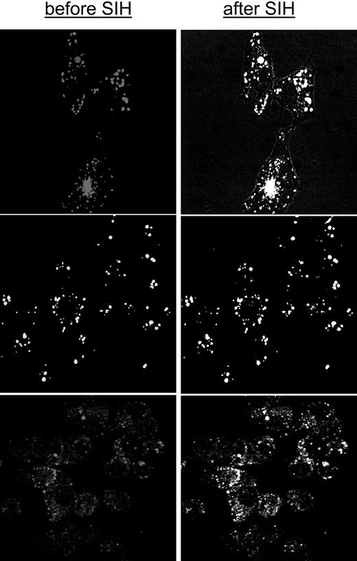 Figure 5. Chelation of endosomal labile iron generated by adsorptive endocytosis of CALG-Fe complexes in different cell types. HepG2 (top), H9C2 (middle), and J774 (bottom) cells were loaded with CALG-Fe complexes (50 μM) by incubating them in growth medium supplemented with 1% serum albumin. The depicted images represent overlays of images obtained before and after addition of 50 μM SIH (1-15 minutes, viewed by epifluorescence and merged with phase microscopy). All incubations and perfusions were carried out at 37°C. Probenecid (0.5 mM) was supplemented in order to minimize leakage of the calcein (CAL). The mean fluorescence intensity levels in the various cells following similar loading treatments and analyzed with equivalent parameters were (in relative terms) 10 for J774, 3 for H9C2, and 1 for HepG2.