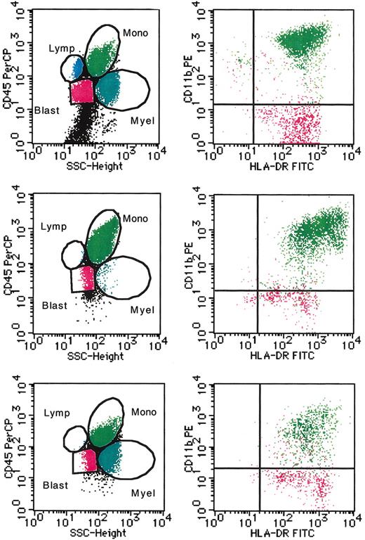 Figure 5. Representative flow cytometric profile of the cells in the suspension culture of JMML BM cells. The nonerythroid BM cells of a patient with JMML (case 4) before (top row) and after 10 days of culture without and with 10 μM ZOL (middle and bottom rows, respectively) were examined by flow cytometry. Populations of granulocytes (Myel, dark blue dots), monocytes/macrophages (Mono, green dots), lymphocytes (Lymp, bright blue dots), and blastic cells (Blast, red dots) were identified by a combination of SSC and CD45 staining (left). CD11b and HLA-DR expression in monocytes/macrophages and blastic cells was further analyzed (right).