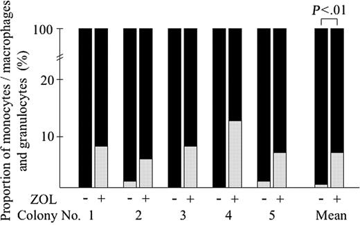 Figure 6. Effect of ZOL on the clonal cells derived from single spontaneous colonies in the culture of JMML BM cells. Five spontaneous colonies generated from BM cells of 3 patients with JMML at day 5 of clonal culture were individually lifted and divided equally, then each half was incubated in the suspension culture with or without 10 μM ZOL for 10 days. The proportion of monocytes/macrophages and granulocytes was determined on cytospin smears of the cultured cells cytochemically stained with α-NBE. ▪ indicates monocytes/macrophages; ▦, granulocytes.