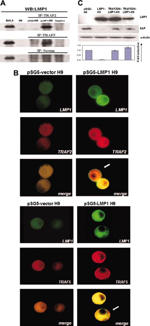 Figure 2. Involvement of TRAF2/5 in LMP1-mediated suppression of SAP on H9 cells. (A) The association between TRAF2/5 and LMP1 on H9 cells. H9 cells were transfected with either pSG5 or pSG5-LMP1 constructs. Cell lysates were immunoprecipitated with antibodies against TRAF2 or TRAF5. The immunoprecipitates were examined by immunoblot with LMP1 antibody. (B) Double immunofluorescence staining revealed colocalization of TRAF2/5 and LMP1 on H9 T cells. Cells were immunostained by antibodies of TRAF2/5 and LMP1, and were observed under confocal microscopy. In LMP1-H9 cells, aggregation and colocalization of TRAF5 or TRAF2 with LMP1 proteins near the cell membrane are shown as indicated by arrows. Original magnification: × 1000 (objective lens: 200 ×). Cells were imaged under Bio-Rad MRC-100 confocal laser scanning (Bio-Rad Microscience Division, Cambridge, MA). The system was connected to a Nikon Diaphot 200 inverted microscope (Nikon, Melville, NY). Images were collected using COMOS software (Bio-Rad) and assembled for publication using Adobe Photoshop 6.0 software (Adobe Systems, San Jose, CA). (C) Recovery of SAP expression on LMP1-H9 cells by TRAF2/5 dominant (DN) mutants. H9 cells were transfected with pSG5 and pSG5-LMP1 along with TRAF2/5 dominant-negative mutant constructs. The expressions of SAP protein were reduced by LMP1 and this inhibitory effect could be rescued by cotransfection with TRAF2/5 dominant-negative mutants. Error bars representing the standard deviation of 3 independent experiments are shown.