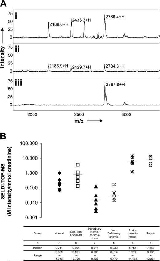 Figure 1. Urine hepcidin profiles by SELDI-TOF-MS, and urine hepcidin levels in different iron metabolism disorders. (A) SELDI-TOF-MS spectra from urine samples of a septicemia patient (i), healthy subject (ii), and human synthetic hepcidin-25 (iii). Urine hepcidin-25 peaks from spectra shown in panel i and panel ii correlate with the reference human synthetic peptide (spectrum shown in panel iii). The annotated peak masses correspond with hepcidin-20, -22, and -25.2 (B) Urinary hepcidin excretion in patients with transfusion-induced iron overload (□), treated hereditary hemochromatosis (▴), iron deficiency anemia (×), endotoxemia after LPS injection (*), and sepsis (○) compared with healthy subjects (♦). In each group the median is indicated.