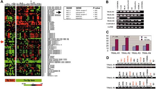 Figure 2. Gene expression analysis of tumors with 8p deletion. (A) Representation of gene expression analysis of cell lines with deletion of 8p (left) and those without genomic deletion (right). Array indicates the position of TRAIL receptor genes in the array. The 5 clones with statistically significant decreased expression in cell lines with deletion versus nondeleted strains are shown. (B) RT-PCR analysis for TRAIL receptor genes and the caspase 8 gene. (C) Flow cytometry analysis for TRAIL receptor genes showed reduced expression for TRAIL-R1 and TRAIL-R2 in deleted versus nondeleted cell lines and patient samples. (D) Methylation analysis: representative examples of cell line samples. U indicates unmethylated; M, methylated; IVD, methylated positive control. In red, cell lines showing methylation of the corresponding gene.