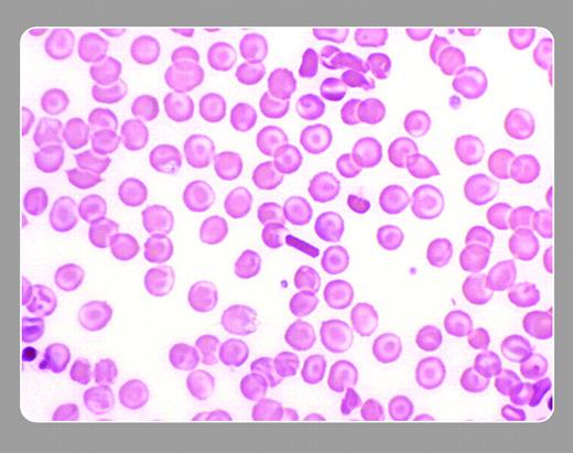 John Lazarchick, Medical University of South Carolina