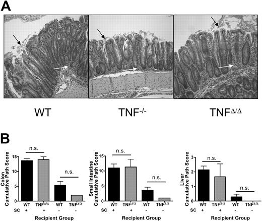 Figure 2. No difference in intestinal GVHD in TNF-deficient hosts using extensive conditioning and allogeneic BMT at either early or late time points. (A) Photomicrograph of colonic tissue sections taken from animals after GVHD induction. Moribund mice from the experiment presented in Figure 1C were humanely killed at day 25 after BMT. Colonic tissue was sectioned and stained by hematoxylin and eosin. Representative photomicrographs are depicted. White arrows designate areas of inflammation. Black arrows designate sloughing of epithelium. (B) No difference in GVHD-associated histologic changes observed in the small intestine, large intestine, and liver of TNFΔ/Δ or WT recipients of allogeneic BM grafts in combination with 3 × 107 spleen cells (SCs) (n = 3/group). Some groups received BM only to control for non–GVHD-associated changes. Mice were assessed 6 days after transplantation. Tissues were assessed for histologic changes in 3 to 4 parameters as described in “Study design” and the sums of these scores are represented for each tissue.