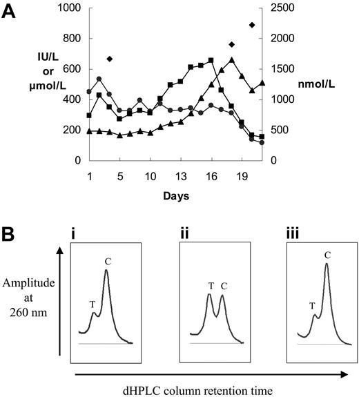 Figure 1. Liver disease in late-onset protoporphyria caused by deletion of an FECH gene in hematopoietic cells. (A) Biochemical tests of liver function and plasma protoporphyrin concentrations during the final phase of the patient's illness. Plasma protoporphyrin (nM) (♦), plasma bilirubin (μM) (▴), plasma alkaline phosphatase (IU/L) (•), and plasma aspartate aminotransferase (IU/L) (▪) measurements are shown. (B) Denaturing HPLC tracings (only homodimer peaks are shown) of intron 3 amplicons from (i) DNA from the patient's unfractionated bone marrow, (ii) germ-line DNA from an FECH IVS3-48C/T heterozygote, and (iii) a mixture of T and C amplicons containing 25% T amplicon.