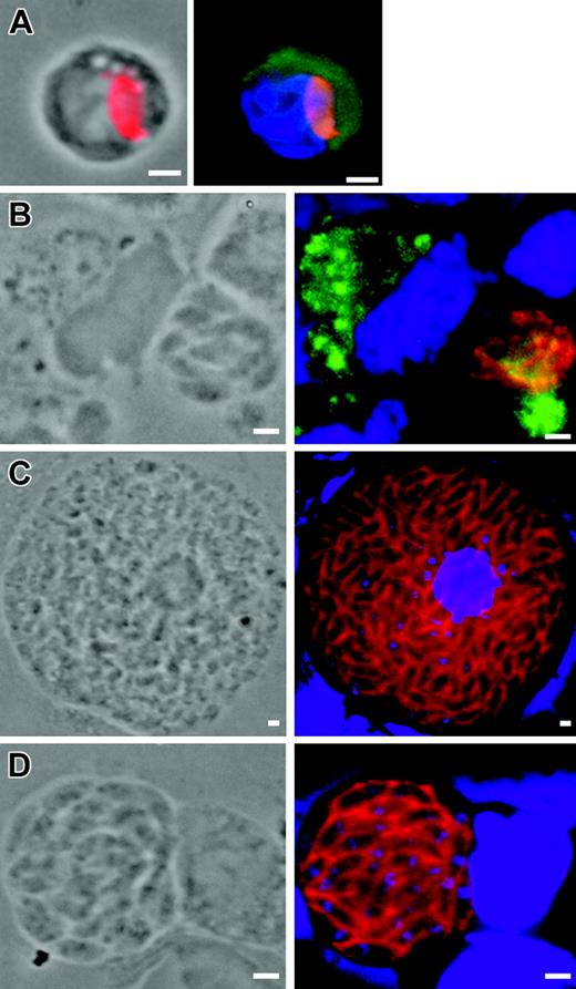 Figure 7. Immunolocalization of T gondii associated to host cells in the brain. (A) Single tachyzoite (anti-SAG1, red) associated with a CD11b+ cell (green) at 7 days after inoculation. (B) Bradyzoites (anti-P36, red) multiplying within a CD11b+ cell (green) at 9 days after inoculation. (C) Tachyzoites and (D) bradyzoites dividing within a CD11c- -CD11b- cell at day 9 after inoculation. Nuclei were stained with DAPI (blue). Scale bar = 2 μm. Images were visualized with a 63×/1.25 Plan-neofluar objective lens (Zeiss).