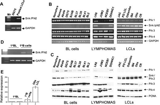 Figure 1. Expression of Snk/Plk2 is down-regulated in lymphomas. (A) Snk/Plk2 mRNA is down-regulated in DG75 BL cells relative to EBV-immortalized B LCLs. RT-PCR was performed to analyze expression of Snk/Plk2 in DG75 and pooled LCLs as indicated. RT-PCR to detect the mRNA of Snk/Plk2 and GAPDH was performed as described in “Materials and methods.” Mr indicates 100-bp molecular weight markers. (B-C) Expression of Plks in normal and neoplastic B lymphocytes. (B) RT-PCR analysis of Plks 1-4 in BL and LCLs and other B-cell lymphomas as shown. The identity of each cell line is shown above the gels. A loading control (GAPDH) is also shown. RNA was isolated from cell lines and expression of each Plk determined by RT-PCR as described in “Materials and methods.” (C) Western blot analysis of Plks 1-4 in BL, LCL, and other B-cell lymphoma cell lines as indicated. The identity of each cell line is shown above the blots. Expression of loading control gene (PCNA) is also shown. Antibodies against Snk/Plk2 recognize a doublet of which the lower band is nonspecific, as previously reported.7 The upper band of the doublet is Snk/Plk2 as described.7 (D) Snk/Plk2 mRNA is detected in primary B lymphocytes but not in primary BL. RT-PCR was performed as described in “Materials and methods.” Mr indicates 100-bp molecular weight markers; lanes are as shown. (E) Real-time RT-PCR analysis of Snk/Plk2 expression in primary BL and primary B cells. Lanes are as shown. Data shown are relative expression levels normalized against the internal control gene ARPO and bars indicate SDs. The results are derived from 3 independent experiments.