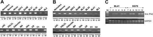 Figure 2. Methylation of the CpG island of SNK/PLK2 but not FNK/PRK/PLK3 in B-cell neoplasia. Methylation-specific PCR (MSP) was performed as described in “Materials and methods” and PCR products resolved on 2% agarose gels. (A) The SNK/PLK2 CpG island is fully methylated in BL cell lines that lack expression of the gene, but completely unmethylated in EBV-immortalized LCLs that express Snk/Plk2. U indicates unmethylated; M, methylated. The toppanel is BL cells lines; the bottom panel, LCLs. The identity of each cell line is shown above the gel. Specificity controls are denoted C1 (control unmethylated DNA) and C2 (control methylated DNA). (B) The CpG island in the FNK/PRK/PLK3 promoter is completely unmethylated in BL. The top panel is BL cells lines; the bottom panel, LCLs. The identity of each cell line is shown above the gel. (C) Demethylation of the SNK/PLK2 CpG island reverses transcriptional silencing. BL lines positive (Rael) and negative (DG75) for EBV and lacking expression of Snk/Plk2 mRNA were exposed to demethylating agents and analyzed by RT-PCR as described in “Materials and methods.” Lanes are: 1 and 7, untreated; 2 and 8, 5 μM 5′AZA; 3 and 9, 10 μM 5′AZA; 4 and 10, 300 μM TSA; 5 and 11, 5 μM 5′AZA plus 300 μM TSA; 6 and 12, 10 μM 5′AZA plus 300 μM TSA.