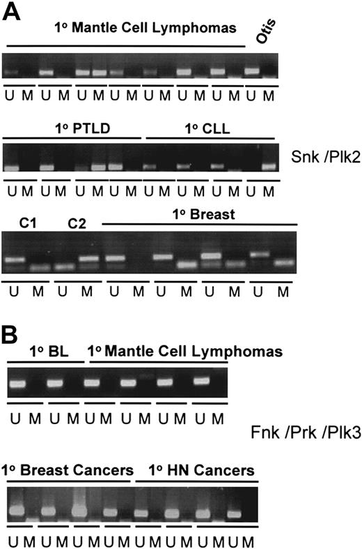 Figure 3. SNK/PLK2 is preferentially and selectively methylated in primary hematologic malignancies. (A) Methylation of the CpG island of SNK/PLK2 occurs in primary B-cell lymphomas but not in breast cancer. MSP analysis of the SNK/PLK2 CpG island was performed as described in “Materials and methods.” The figure shows MSPs for unmethylated (U) and methylated (M) DNA. Specificity controls are denoted C1 (control unmethylated DNA) and C2 (control methylated DNA). Examples of methylation are shown for primary mantle-cell lymphomas, posttransplantation lymphoproliferative disease (PTLD), chronic lymphocytic leukemia (CLL), and primary breast cancer. The lymphoblastoid cell line Otis is included as a further specificity control. (B) PLK3 (FNK/PRK/PLK3) is unmethylated in B-cell, breast, and head and neck cancer. MSP to detect methylation in the CpG island of FNK/PRK/PLK3 was performed as described in “Materials and methods.” The figure shows MSPs for unmethylated (U) and methylated (M) DNA. Shown are analysis of primary BL, primary mantle-cell lymphomas, primary breast cancer, and primary squamous carcinomas of the head and neck (HN).