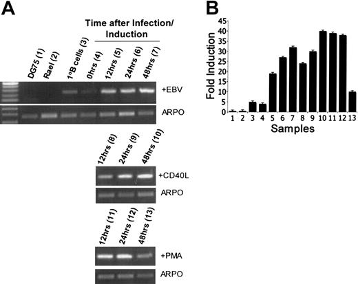 Figure 4. Activation of primary B cells leads to SNK/PLK2 gene expression. Primary B cells were treated with CD40 ligand or PMA, or infected with immortalizing strains of EBV as shown. Expression of Snk/Plk2 and the control gene ARPO was analyzed using RT-PCR and real time RT-PCR at different time points after activation/infection as described in “Materials and methods.” (A) RT-PCR showing mRNA expression of Snk/Plk2 and ARPO. Time points are shown above the gel. The top panel shows infection with EBV, the middle panel shows treatment with CD40 ligand, and the bottom panel shows treatment with PMA. (B) Real-time PCR analysis showing expression of Snk/Plk2 mRNA. ARPO was used as an internal control. The figure shows fold induction of Snk/Plk2 corrected for levels of the control gene ARPO (± 1 SD). Values obtained are derived from 3 independent experiments. Lanes are as indicated in brackets in panel A.