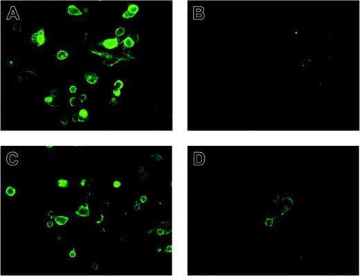 Figure 5. Specific binding of IL-16 to CD9-expressing CHO cells. CHO cells transfected with pcDNA3 alone (B) or pcDNA3 containing a CD9 cDNA (A,C-D) were seeded in 24-well chamber slides. Three days later, the cultured cells were washed and preincubated with no Ab (A-B), isotype-matched mouse IgG (C), or anti-CD9 mAb (D). The binding of IL-16 to the transfectants was visualized using Alexa Fluor-488–conjugated IL-16 and was evaluated by fluorescence microscopy using a Leica Microsystems Diaplan fluorescence microscope and 25×/0.60 water immersion objective. Images were acquired using a Leica Microsystems DFC 480 digital camera and Leica Microsystems DFC Twain 6.1.1 software. Final images were processed using Adobe Photoshop 7.0.1 (Adobe Systems, San Jose, CA).