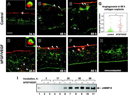 Figure 1. Angiogenesis in the collagen CAM onplants is accompanied by infiltration of chMMP-9–positive heterophils and accumulation of chMMP-9 protein. Collagen onplants were supplemented with buffer alone (control onplants: panels A, C, E) or angiogenic growth factors (bFGF/VEGF: panels B, D, F, H). Collagen onplants with the underlying CAM were harvested at 24 hours (A-B), 48 hours (C-D), or 66 hours (E-F, H), embedded in OCT compound, and frozen. Cryosections were immunostained for chMMP-9 with an affinity-purified rabbit polyclonal antibody (red). Tissue sections were counterstained with YO-PRO-1 iodide resulting in green-stained cell nuclei. The blank circular areas represent areas previously occupied by the 2-tiered nylon meshes, which are frequently displaced during tissue processing. At low magnification, scattered chMMP-9 staining appears to be associated with individual cells or small clusters of cells (arrowheads). The insets in panels A and B illustrate at higher magnification heterophils with distinctively shaped nuclei (green) and cytoplasmic chMMP-9–positive granules (red). * indicates specific staining of the extracellular fibrils for chMMP-9 in panel F. lu denotes the lumens of large blood vessels in panels B, C, and E; #, the bright ribbonlike staining at the upper border of the collagen-air interface in panel A. In panel H, a 66-hour growth factor–containing onplant is chMMP-9 negative after the chMMP-9 antibody was immunodepleted by preincubation with purified chMMP-9, confirming the specificity of the staining in the other panels. Bar represents 200 μm. The scatter graph (G) illustrates the levels of angiogenesis in control and growth factor–containing (bFGF/VEGF) onplants scored at 66 hours and presented as a fraction of grids with newly developed blood vessels (mean ± SEM). *P < .001. (I) Expression of chMMP-9 protein in the collagen CAM onplants. At 3 hours (lanes 2-3), 17 hours (lanes 4-5), 26 hours (lanes 6-7), 50 hours (lanes 8-9), and 66 hours (lanes 10-11) the collagen onplants with (+) or without (-) angiogenic growth factors (bFGF/VEGF) were excised from the CAM, pooled, extracted, and analyzed by SDS-PAGE and Western blotting with chMMP-9 antibody. As a positive control, the chMMP-9 proenzyme produced by PMA-treated chicken monocytic cells (HD11) was run in lane 1 (2 μL of cell lysate). The position of 75-kDa chMMP-9 is indicated on the right.