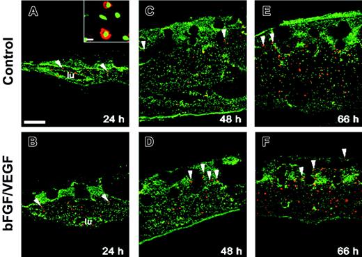 Figure 2. Cells of monocyte/macrophage lineage infiltrate the collagen CAM onplants. Collagen on-plants supplemented with buffer alone (A,C,E) or bFGF/VEGF (B,D,F) were harvested with the underlying CAM at 24 hours (A-B), 48 hours (C-D), and 66 hours (E-F), embedded in OCT compound, and frozen. Cryosections were immunostained with a chicken monocyte/macrophage-specific monoclonal antibody (red). The sections were counterstained with YO-PRO-1 iodide, resulting in green-stained cell nuclei. (A-B) At 24 hours, positively stained cells (arrowheads) were present only in the underlying CAM. (C-F) By 48 to 66 hours, positively stained monocytes/macrophages appeared also in the upper areas of onplants as isolated cells or clusters of cells. Bar represents 200 μm. At a higher magnification (A inset; bar represents 20 μm), the stained cells display macrophage-like morphologic characteristics (rounded or bean-shaped nuclei and a relatively high cytoplasm-to-nucleus ratio). lu denotes the lumens of large vessels. Large, unstained, circular areas in the upper portions of the sections represent the sites where the grids of nylon meshes were displaced during the processing of sections.